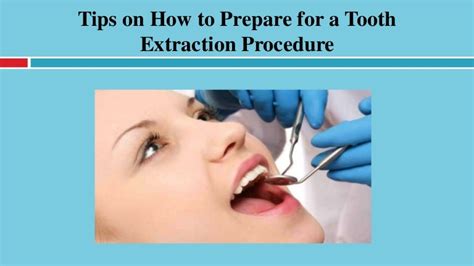 Tips on How to Prepare for a Tooth Extraction Procedure