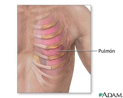 Anatomía del pulmón y costillas: MedlinePlus enciclopedia médica illustración