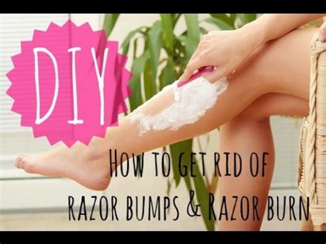 Get Rid Of Bumps Legs - get rid of bumps