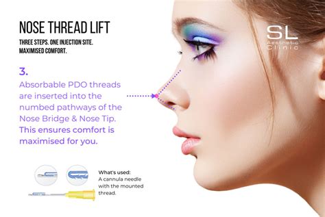 All You Need To Know About Nose Threadlift in Singapore | SL Aesthetic