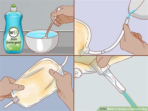 How to Empty a Catheter Bag: 14 Steps (with Pictures) - wikiHow