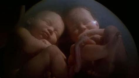 Twin Babies Caught On MRI Scan Fighting In Their Mother's Womb! Amazing! - Faithreel.com