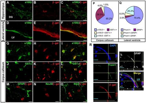 Prom1 is expressed in mature glial cells and SVZ astrocytes in the... | Download Scientific Diagram