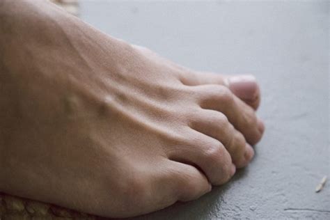 7 Signs of Arthritis in Your Feet - Foot and Ankle Group