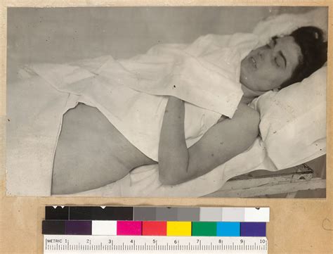 Morgue photograph of Virginia Rappe.