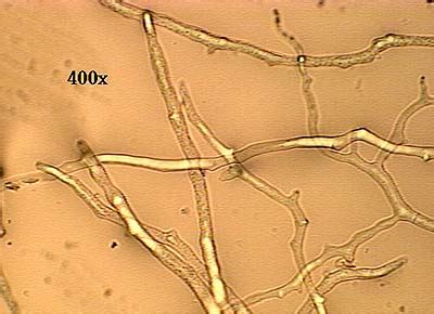 coenocytic hyphae