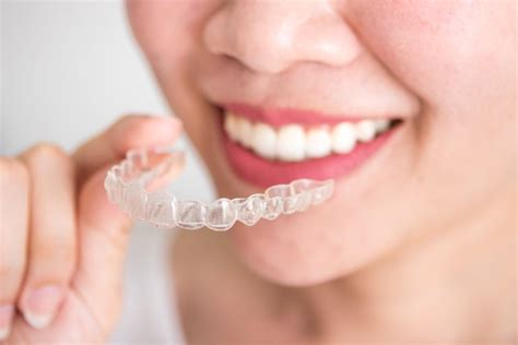 The Invisible Solution: All About Clear Retainers