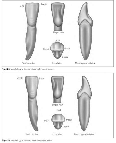 Mandibular incisors - Dental Technology: How-To, Tips | Dental anatomy, Dental, Canine dental