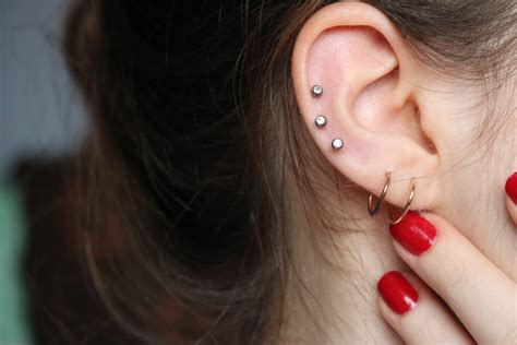 Infected Ear Cartilage Piercing