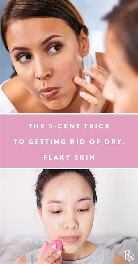 The 5-Cent Trick to Getting Rid of Dry, Flaky Skin | Flaky skin, Facial skin, Better skin