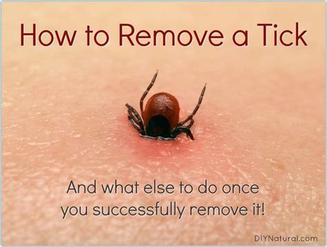 How to Remove A Tick: What to Do Right Away Once You've Been Bitten | Ticks, How to remove, Get ...