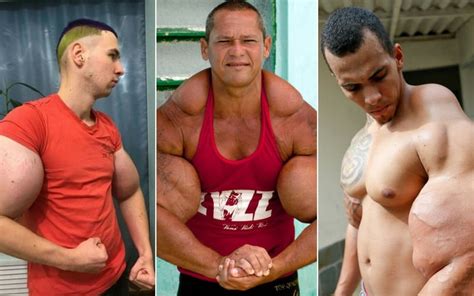 What is Synthol and it's side effects? — MO Marketplace