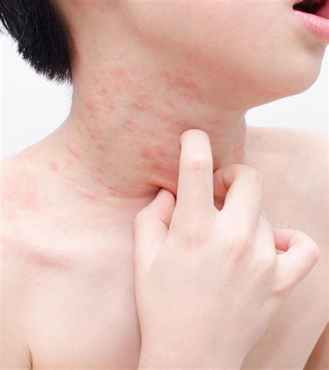 Skin Rashes In Children: Causes And Treatment