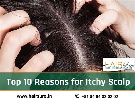 Top 10 Reasons for Itchy Scalp | Hair Sure