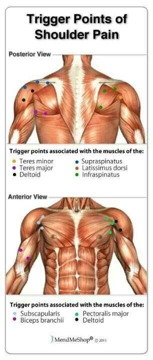 Trigger Points of Shoulder Pain | Massage Therapy & Bodywork | Pinter…