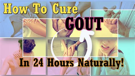 How To cure Gout In 24 Hours Naturally ! Cure Acute Gout Permanently! Gout Flare Ups - YouTube