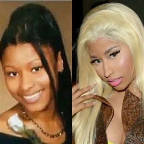 Skin Bleaching Gone Wrong