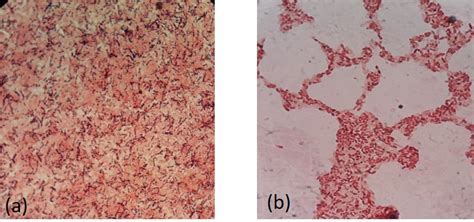 Gram staining of bacteria (a). Brevibacterium sp.(B4) Gram +Ve, Chain ...