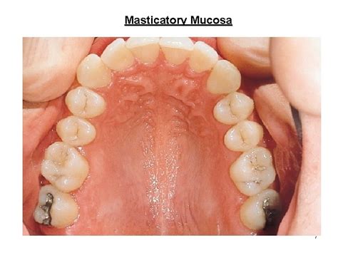 Oral Mucosa Part 1 1 Oral Mucosa Mucous