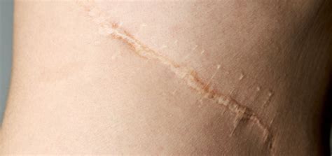 Medical Conditions | Dermatology and Skin Health - Dr. Mendese