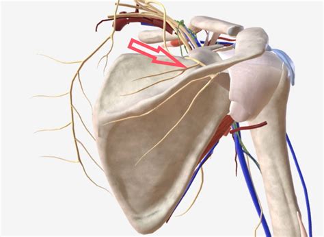 Relieving Shoulder Pain with Suprascapular Nerve Block