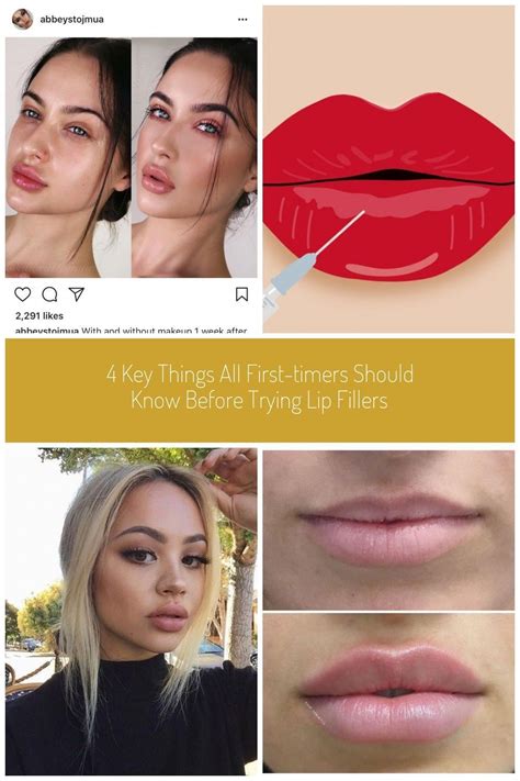 Lip goals...Lip fillers #LipFillers1Ml #lip fillers #lipsfillers Lip ...