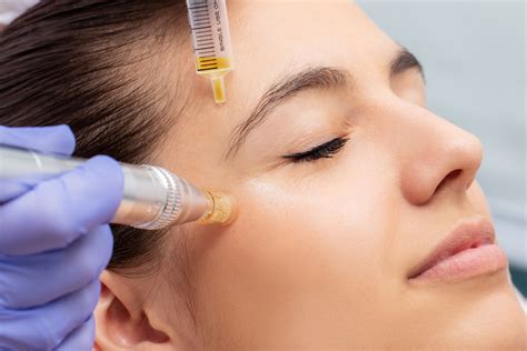 Micro-Needling Treatments in Dallas, TX | OMNI SCULPT MD