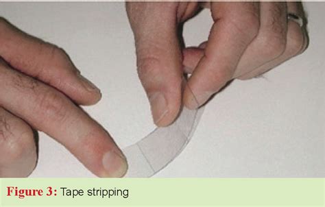 Figure 1 from On dermal exposure assessment. | Semantic Scholar