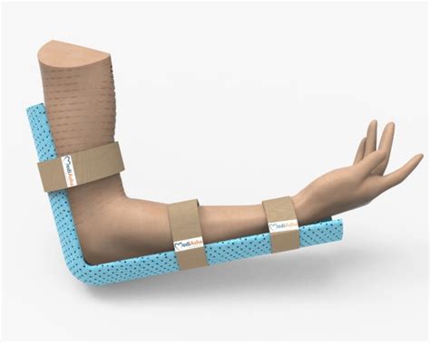 Orthopaedic splint FractoAid immobilises fractured limbs instantly, prevents possible disability ...