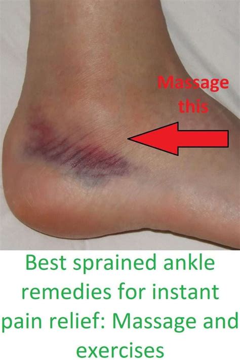 Sprained ankle cause, symptoms, and treatment with exercises