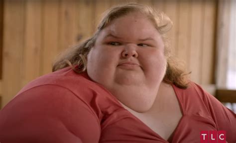 What Happened To Tammy Slaton Forehead In 1000-lb Sisters? - Trendzified