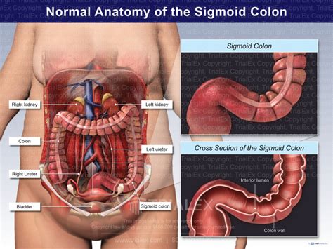 Normal Anatomy of the Sigmoid Colon - TrialExhibits Inc.