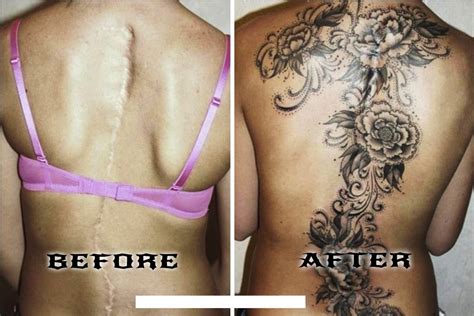 Amazing Scar-Covering Tattoos - Epic Cover Up - YouTube
