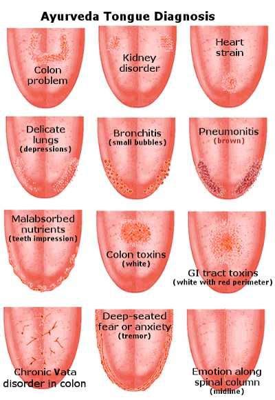 Mouth Ulcer Symptoms In Malayalam