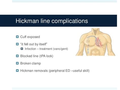 Haemodialysis complications