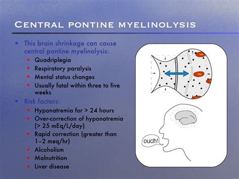 Central pontine myelinolysis as related to Hypoxia - Pictures