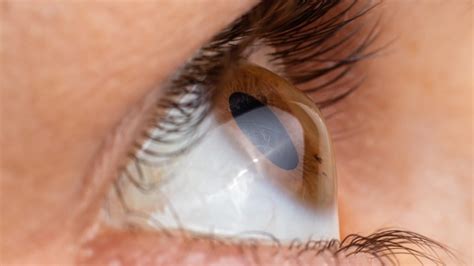 When were contact lenses invented? | Clearly Blog - Eye Care & Eyewear Trends