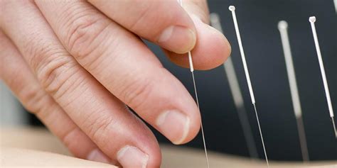 Acupuncture MS Program in CT | University of Bridgeport