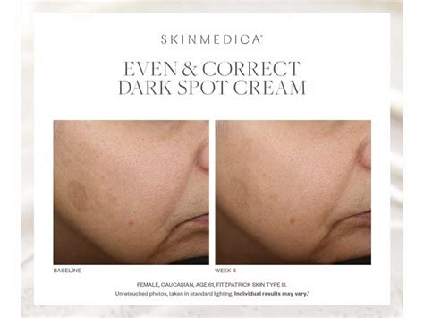 SkinMedica Even & Correct Treatment Pads - On Sale! Order Now.