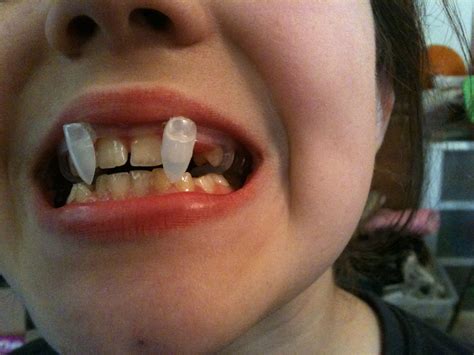 easy way to make fake vampire teeth