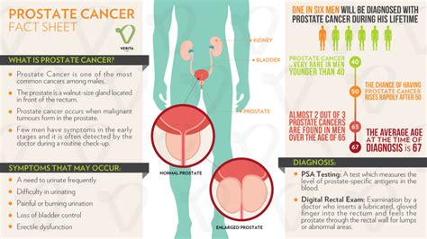 Can Green Tea Reduce The Risk Of Prostate Cancer? - Verita Life