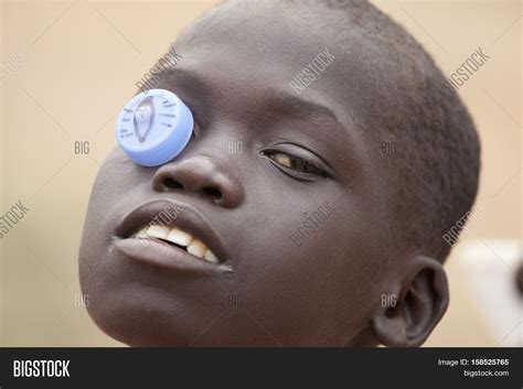 TORIT,, SOUTH SUDAN- Image & Photo (Free Trial) | Bigstock