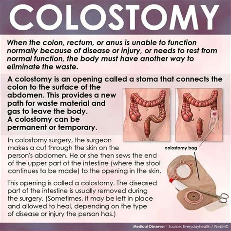 Colostomy Oral Health, Physical Health, Healthy Tips, Healthy Body ...