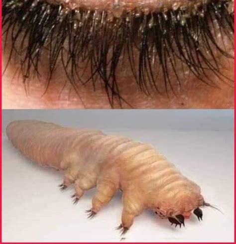 List 99+ Wallpaper Eyelash Pictures Of Demodex Mites On Humans Full HD, 2k, 4k 11/2023