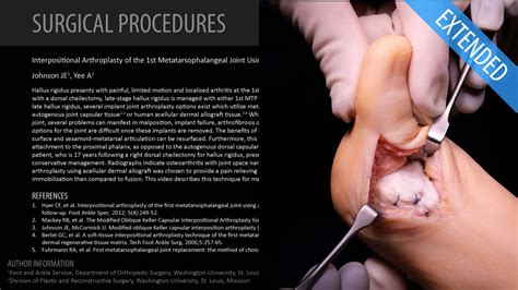 Arthroplasty of the 1st MTP Joint Using Acellular Allograft - Extended ...