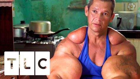 WATCH: New Documentary on Synthol Freaks - Updated – Fitness Volt