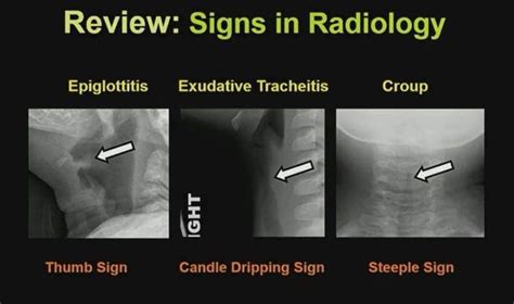 Pin on X-Ray