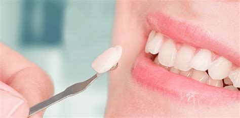 How Porcelain Veneers Are Changing Lives | Kennedy Dental Cosmetics