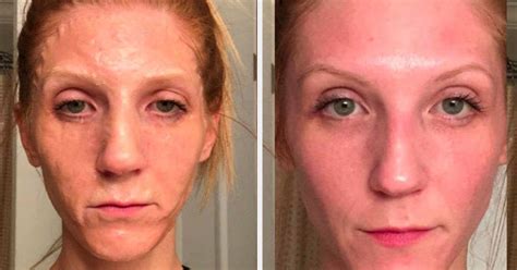 8 Face Masks With Before-And-After Photos That Might Make You A Believer