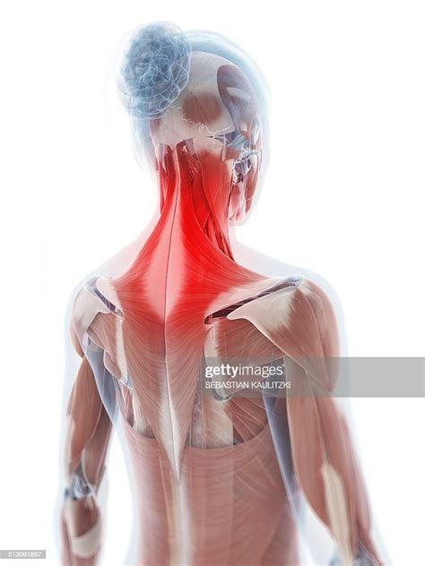 Human Neck Pain Artwork High-Res Vector Graphic - Getty Images